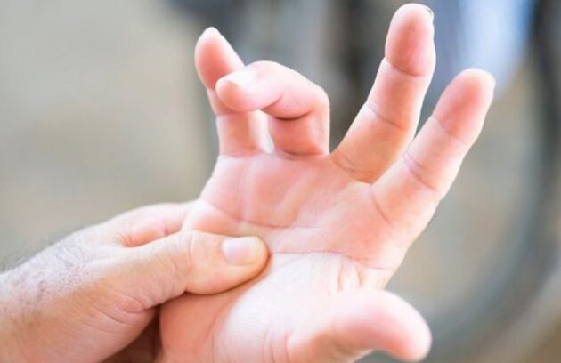 Imagem de uma mão direcionando para o local que acontece a lesão quando o paciente apresenta dedo de gatilho