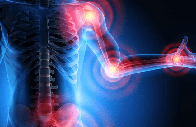 Imagem do corpo humano de costas com luzes vermelhas destacando o pulso, cotovelo, ombro e lombar. Locais que podemos ter câncer ósseo.